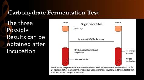 Oxidative fermentative (OF) test: Principle, Procedure, .